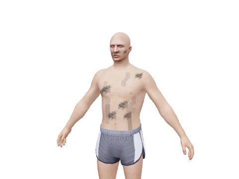 Burnt_Ped_Head_Torso, a GTA V damage pack or decal